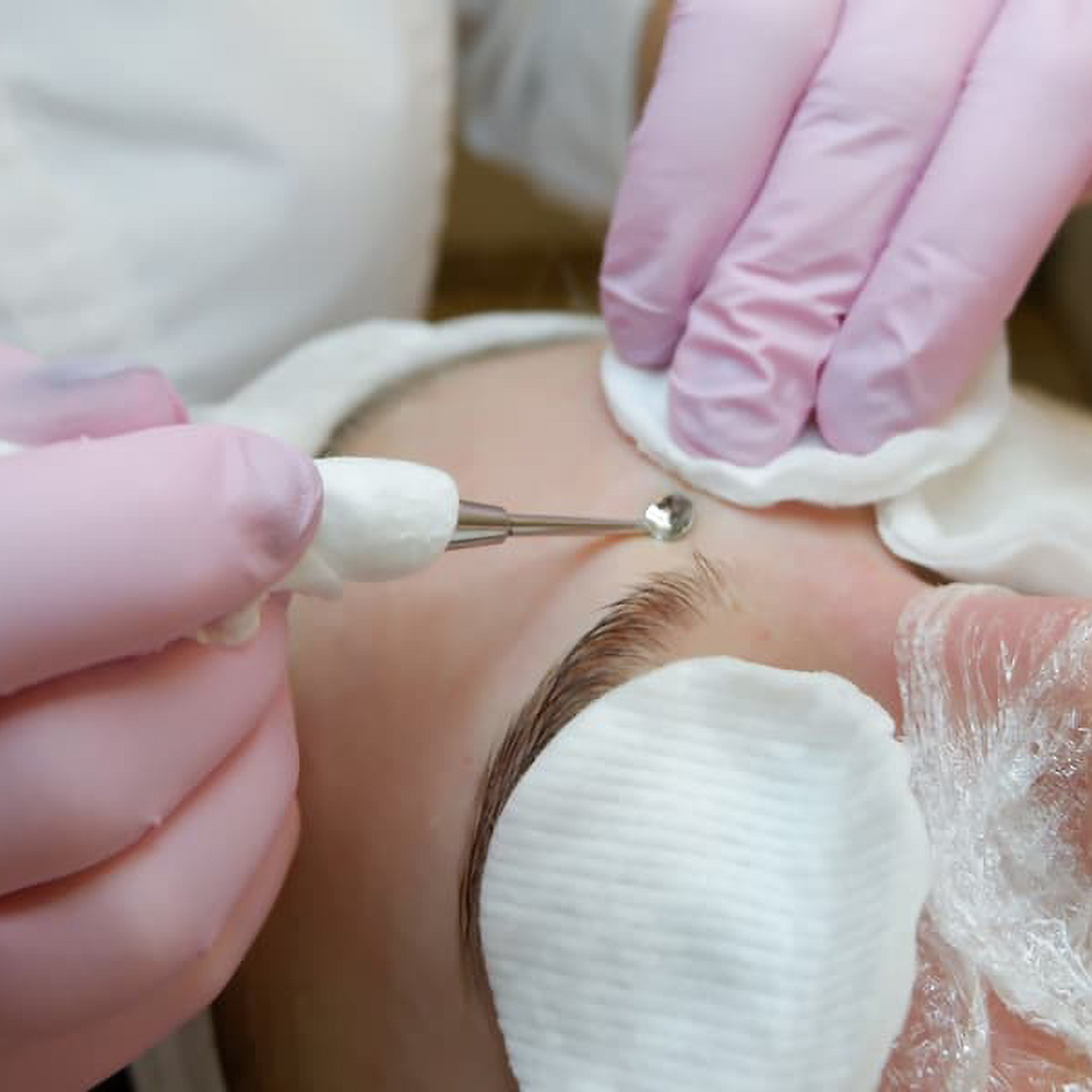 Професійне лікувальне очищення шкіри обличчя